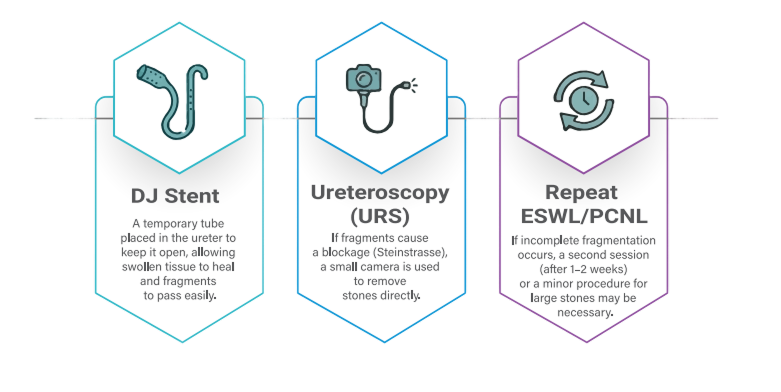 Ureteroscopy-image