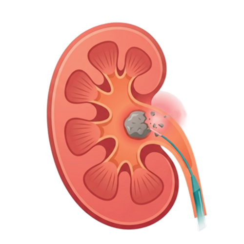 RIRS Comprehensive Patient Guide